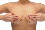 Closeup Foto eines kaukasischen Frau die BrÃ¼ste mit Linien fÃ¼r Brust-Modifikation isoliert auf weiÃŸ markiert Lizenzfreie Bilder - 14446827