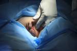 Chirurg legte den Finger in die Hoden eines Patienten während der Operation Lizenzfreie Bilder - 50525126