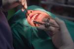 Anästhesie für Zahnextraktion durch den Zahnarzt. Zahnmedizin im Krankenhaus. Lizenzfreie Bilder - 72605715
