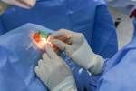 Augenchirurgie Lizenzfreie Bilder - 20336892