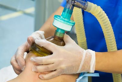 Patientin mit Vollnarkose