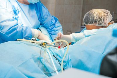 Gynäkologische diagnostische Bauchspiegelung