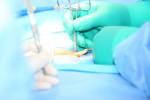 Öffnen Hernienchirurgie Lizenzfreie Bilder - 30487327
