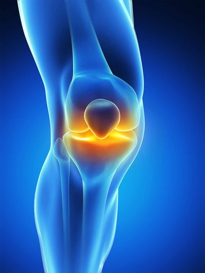 Knorpelglättung Knie
