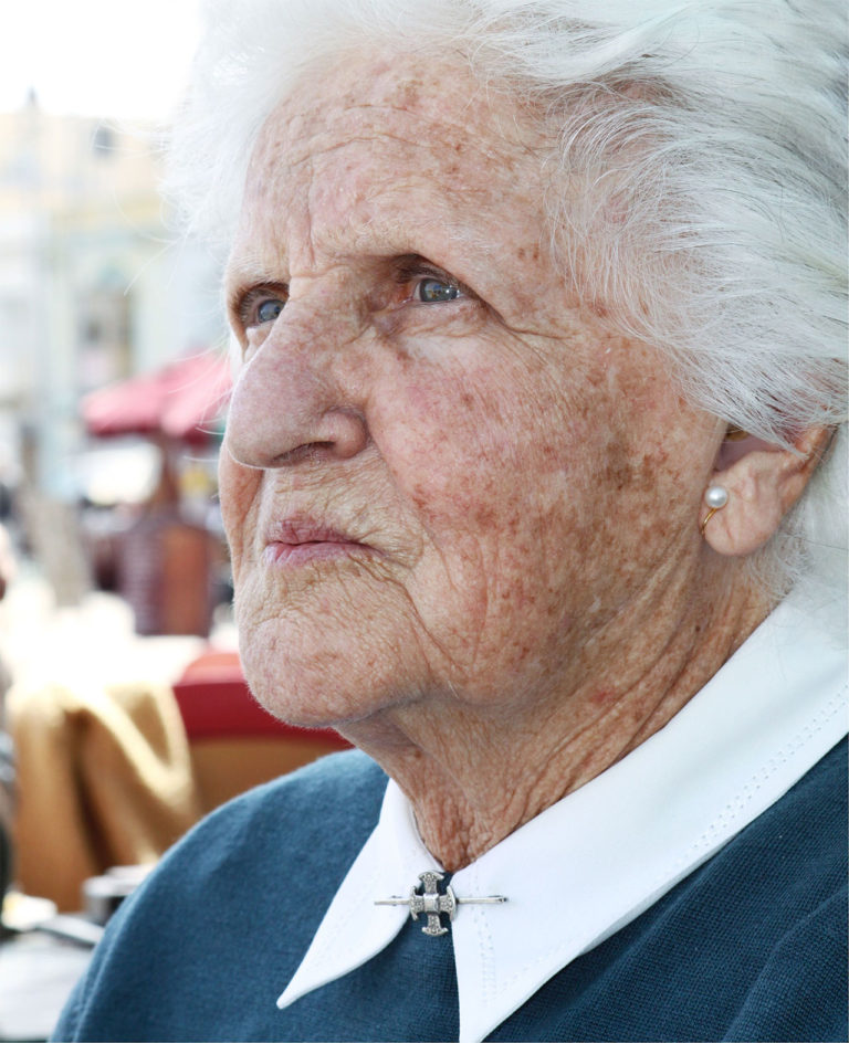 Frau mit Altersflecken