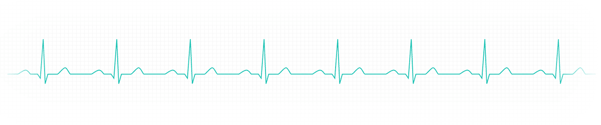 EKG Linie