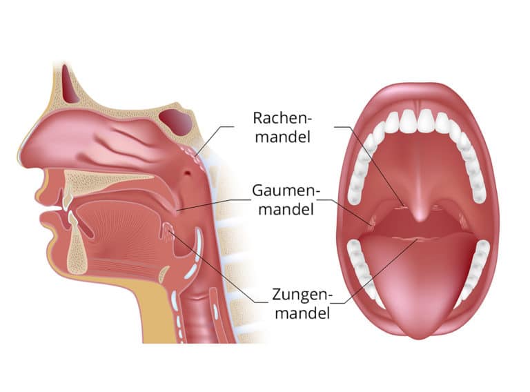 Rachenmandeln Schema